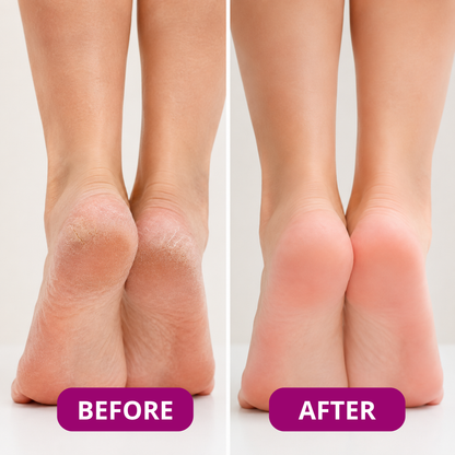 Elastic Silicone Moisturizing Foot Socks for Dry